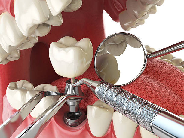 Best Emergency Dental Surgery in Jackson, SC